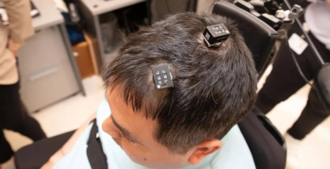 Um tratamento de implante cerebral com IA promete revolucionar a vida de milhões!