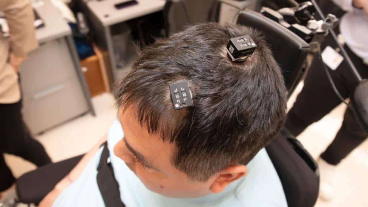Um tratamento de implante cerebral com IA promete revolucionar a vida de milhões!